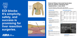 Thumbnail for EXTERNAL OBLIQUE INTERCOSTAL FASCIAL PLANE BLOCK FOR PATIENTS UNDERGOING OPEN HEPATECTOMY SURGERIES: A CASE SERIES.