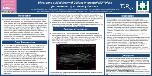 Preview of ULTRASOUND GUIDED EXTERNAL OBLIQUE INTERCOSTAL (EOI) BLOCK FOR UNPLANNED OPEN CHOLECYSTECTOMY.