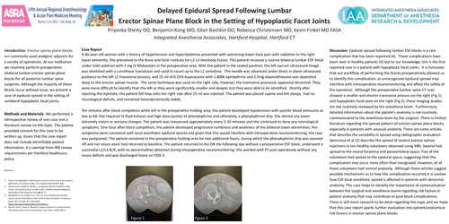 Preview of DELAYED EPIDURAL SPREAD FOLLOWING LUMBAR ERECTOR SPINAE PLANE BLOCK IN THE SETTING OF HYPOPLASTIC FACET JOINTS