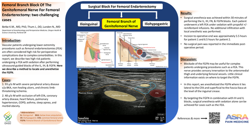 Preview of ULTRASOUND GUIDED FEMORAL BRANCH BLOCK OF THE GENITOFEMORAL NERVE FOR FEMORAL ENDARTERECTOMY: A CASE REPORT