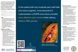 Thumbnail for SURGICAL PLACEMENT AND POST-OP MANAGEMENT OF LUMBAR MULTIFIDUS AND ERECTOR SPINAE NERVE BLOCK CATHETERS FOR COMPLEX LUMBAR SURGERY