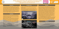 Thumbnail for ERECTOR SPINAE PLANE BLOCK WITH SUPERFICIAL CERVICAL PLEXUS BLOCK FOR ANALGESIA IN A PATIENT UNDERGOING FIRST RIB RESECTION