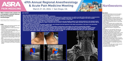 Thumbnail for WHEN A LIPOMA IS NOT A LIPOMA: REGIONAL ANESTHESIOLOGIST IDENTIFYING A MASS WITH SONOGRAPHY