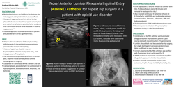 Thumbnail for NOVEL ANTERIOR LUMBAR PLEXUS VIA INGUINAL ENTRY (ALPINE) CATHETER FOR REPEAT HIP SURGERY IN A PATIENT WITH OPIOID USE DISORDER