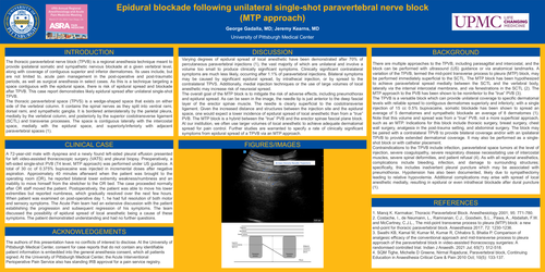 Preview of EPIDURAL BLOCKADE FOLLOWING UNILATERAL SINGLE-SHOT PARAVERTEBRAL NERVE BLOCK (MTP APPROACH)