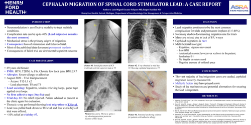 Preview of CEPHALAD MIGRATION OF SPINAL CORD STIMULATOR LEAD DURING TRIAL: A CASE REPORT