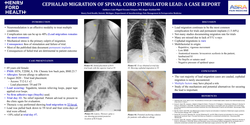 Thumbnail for CEPHALAD MIGRATION OF SPINAL CORD STIMULATOR LEAD DURING TRIAL: A CASE REPORT