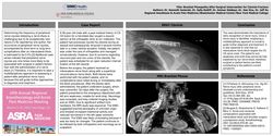 Thumbnail for BRACHIAL PLEXOPATHY AFTER SURGICAL INTERVENTION FOR CLAVICLE FRACTURE