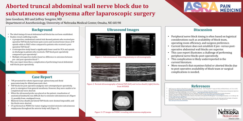 Preview of ABORTED TRUNCAL ABDOMINAL WALL NERVE BLOCK DUE TO SUBCUTANEOUS EMPHYSEMA AFTER LAPAROSCOPIC SURGERY