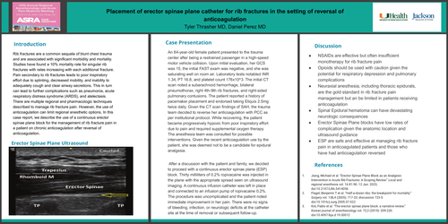 Preview of PLACEMENT OF ERECTOR SPINAE PLANE CATHETER FOR RIB FRACTURES IN THE SETTING OF REVERSAL OF ANTICOAGULATION