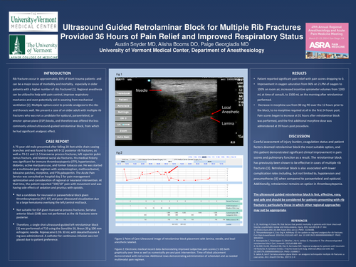 Preview of ULTRASOUND GUIDED RETROLAMINAR BLOCK FOR MULTIPLE RIB FRACTURES PROVIDED 36 HOURS OF PAIN RELIEF AND IMPROVED RESPIRATORY STATUS
