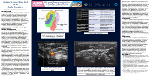 Preview of ULTRASOUND-GUIDED SCALP BLOCK FOR AN AWAKE CRANIOTOMY