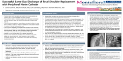 Thumbnail for SUCCESSFUL SAME-DAY DISCHARGE OF TOTAL SHOULDER REPLACEMENT WITH PERIPHERAL NERVE CATHETER
