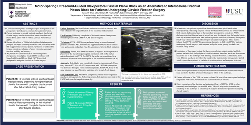 Preview of MOTOR-SPARING CLAVIPECTORAL FASCIAL PLANE BLOCK AS AN ALTERNATIVE TO INTERSCALENE BLOCK FOR PATIENTS UNDERGOING CLAVICLE FIXATION