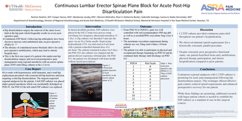 Preview of ERECTOR SPINAE PLANE BLOCK (ESPB) FOR POST- HIP DISARTICULATION ANALGESIA