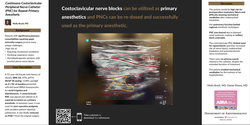 Thumbnail for CONTINUOUS COSTOCLAVICULAR PERIPHERAL NERVE CATHETER (PNC) FOR REPEAT PRIMARY ANESTHETIC