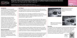 Thumbnail for DIAGNOSTIC ULTRASOUND-GUIDED REGIONAL BLOCKADE TO FACILITATE PERIPHERAL SCHWANNOMA RESECTION