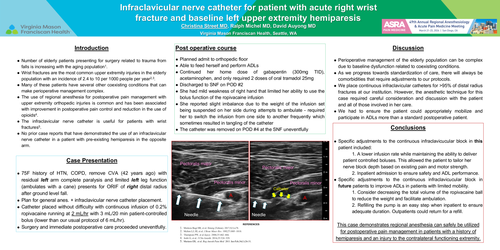 Preview of INFRACLAVICULAR NERVE CATHETER FOR PATIENT WITH ACUTE RIGHT WRIST FRACTURE AND BASELINE LEFT UPPER EXTREMITY HEMIPARESIS