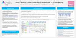 Thumbnail for BONE CEMENT IMPLANTATION SYNDROME GRADE 3: A CASE REPORT