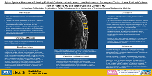 Preview of SPINAL EPIDURAL HEMATOMA FOLLOWING EPIDURAL CATHETERIZATION IN YOUNG, HEALTHY MALE AND SUBSEQUENT TIMING OF NEW EPIDURAL CATHETER