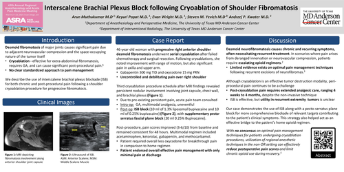 Preview of INTERSCALENE BRACHIAL PLEXUS BLOCK FOLLOWING CRYOABLATION OF SHOULDER FIBROMATOSIS