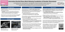 Thumbnail for INTERSCALENE BRACHIAL PLEXUS BLOCK FOLLOWING CRYOABLATION OF SHOULDER FIBROMATOSIS