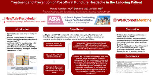 Preview of TREATMENT AND PREVENTION OF POST-DURAL PUNCTURE HEADACHE IN THE LABORING PATIENT