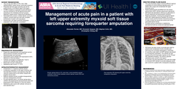 Thumbnail for MANAGEMENT OF ACUTE PAIN IN A PATIENT WITH A LEFT UPPER EXTREMITY MYXOID SOFT TISSUE SARCOMA REQUIRING FOREQUARTER AMPUTATION
