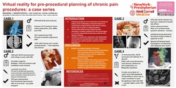 Thumbnail for VIRTUAL REALITY FOR PREPROCEDURAL PLANNING OF CHRONIC PAIN PROCEDURES: A CASE SERIES