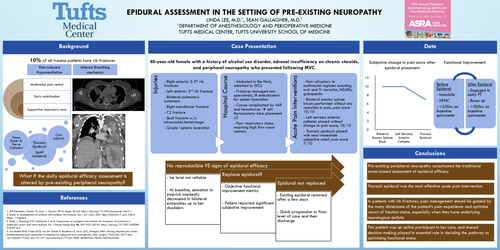 Preview of EPIDURAL ASSESSMENT IN THE SETTING OF PRE-EXISTING NEUROPATHY