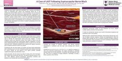 Thumbnail for SYMPTOMS OF LOCAL ANESTHETIC SYSTEMIC TOXICITY (LAST) AFTER SUPRASCAPULAR NERVE BLOCK
