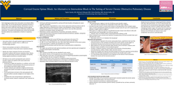 Thumbnail for CERVICAL ERECTOR SPINAE BLOCK: AN ALTERNATIVE TO INTERSCALENE BLOCK IN THE SETTING OF SEVERE CHRONIC OBSTRUCTIVE PULMONARY DISEASE