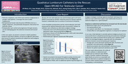Thumbnail for QUADRATUS LUMBORUM CATHETERS TO THE RESCUE: OPEN RPLND FOR TESTICULAR CANCER