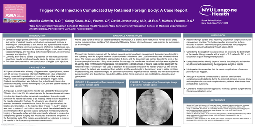 Preview of TRIGGER POINT INJECTION COMPLICATED BY RETAINED FOREIGN BODY: A CASE REPORT