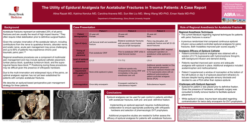 Preview of THE UTILITY OF EPIDURAL ANALGESIA FOR ACETABULAR FRACTURES IN TRAUMA PATIENTS: A CASE REPORT