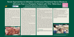 Thumbnail for NOVEL APPROACHES AND UTILIZATION OF CONTINUOUS PERIPHERAL NERVE BLOCKS TO MINIMIZE PAIN IN A PEDIATRIC PATIENT WITH 70% TBSA BURN