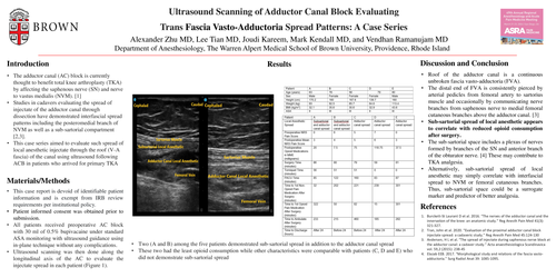 Preview of ULTRASOUND SCANNING OF ADDUCTOR CANAL BLOCK EVALUATING TRANS FASCIA VASTO-ADDUCTORIA SPREAD PATTERNS: A CASE SERIES