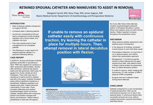 Preview of RETAINED EPIDURAL CATHETER AND MANEUVERS TO ASSIST IN REMOVAL