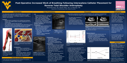 Thumbnail for POST-OPERATIVE INCREASED WORK OF BREATHING FOLLOWING INTERSCALENE CATHETER PLACEMENT FOR REVERSE TOTAL SHOULDER ARTHROPLASTY