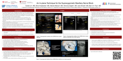 Thumbnail for UNCOMMON SIDE-EFFECTS FROM THE SUPRAZYGOMATIC MAXILLAR NERVE BLOCK WITH OUT-OF-PLANE ULTRASOUND GUIDANCE TECHNIQUE