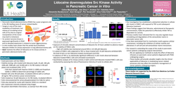 Thumbnail for LIDOCAINE DOWNREGULATES SRC KINASE ACTIVITY IN PANCREATIC CANCER IN VITRO