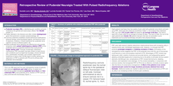 Thumbnail for RETROSPECTIVE REVIEW OF PUDENDAL NEURALGIA TREATED WITH PULSED RADIOFREQUENCY ABLATIONS