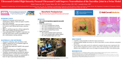 Preview of ULTRASOUND-GUIDED HIGH-INTENSITY FOCUSED ULTRASOUND COULD IMPROVE NEUROABLATION OF THE SACROILIAC JOINT IN A SWINE MODEL