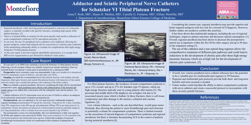 Preview of ADDUCTOR AND SCIATIC PERIPHERAL NERVE CATHETERS FOR SCHATZKER VI TIBIAL PLATEAU FRACTURE