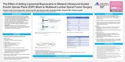 Thumbnail for THE EFFECT OF ADDING LIPOSOMAL BUPIVACAINE TO BILATERAL ULTRASOUND-GUIDED ESP BLOCK TO MULTILEVEL LUMBAR SPINAL FUSION SURGERY
