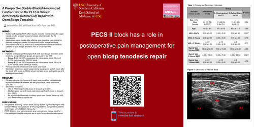 Preview of DOUBLE-BLINDED RANDOMIZED CONTROL TRIAL ON THE PECS II BLOCK IN ARTHROSCOPIC ROTATOR CUFF REPAIR WITH OPEN BICEPS TENODESIS