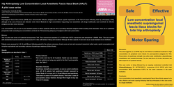 Thumbnail for HIP ARTHROPLASTY LOW CONCENTRATION LOCAL ANESTHETIC FASCIA ILIACA BLOCK (HALF): A PILOT CASE SERIES