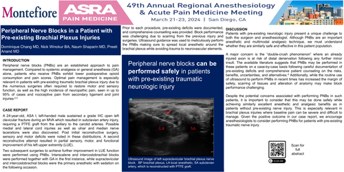 Preview of PERIPHERAL NERVE BLOCKS IN PRE-EXISTING BRACHIAL PLEXUS INJURIES