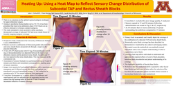 Thumbnail for HEATING UP: USING A HEAT MAP TO REFLECT SENSORY CHANGE DISTRIBUTION OF SUBCOSTAL TAP AND RECTUS SHEATH BLOCKS