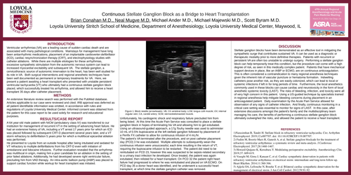 Preview of CONTINUOUS STELLATE GANGLION BLOCK AS A BRIDGE TO HEART TRANSPLANTATION